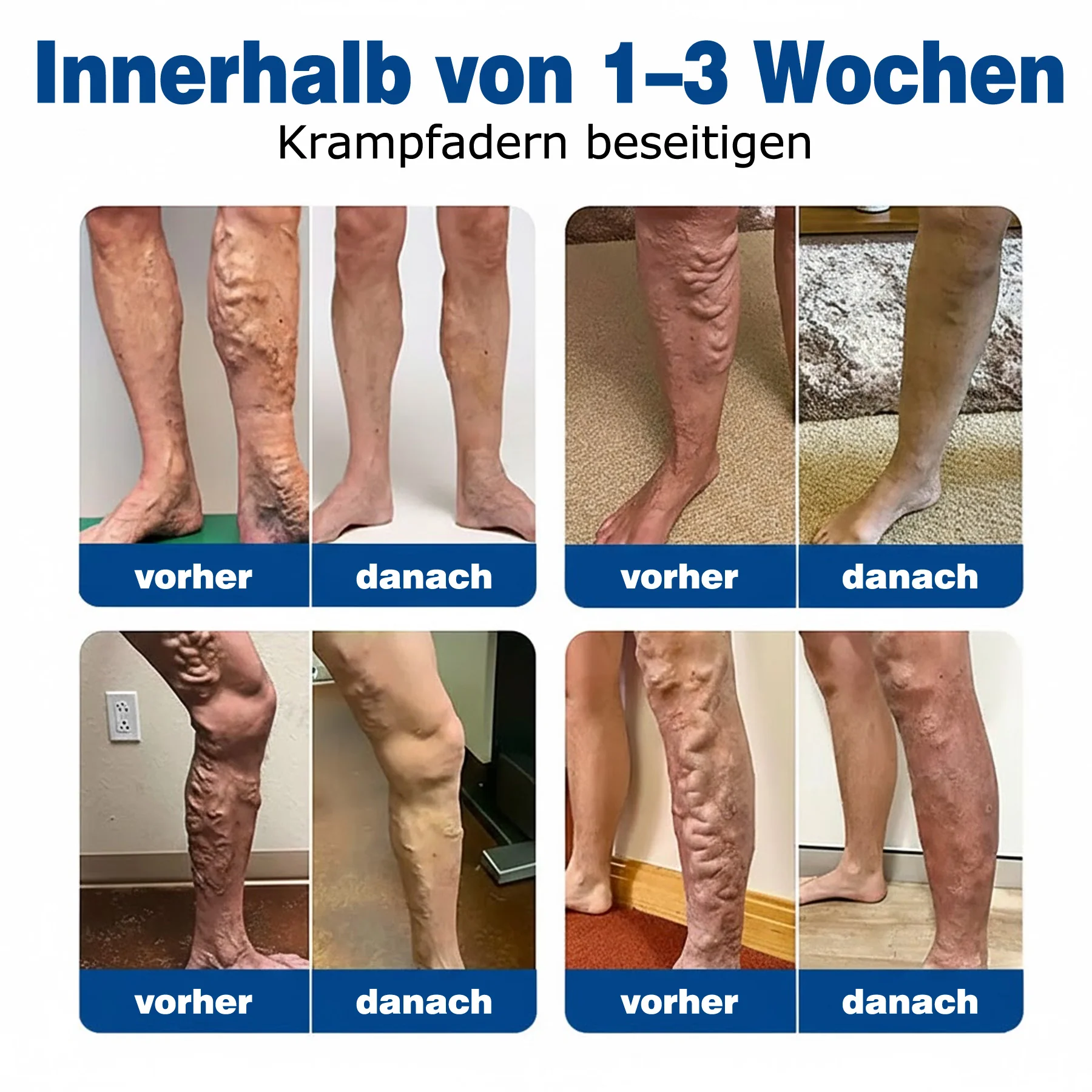 🇩🇪👨⚕️💥 GFOUK® VeinTarget Mikronadel-Pflaster ⚡ Sofortige Linderung, Langfristige Ergebnisse - Image 3