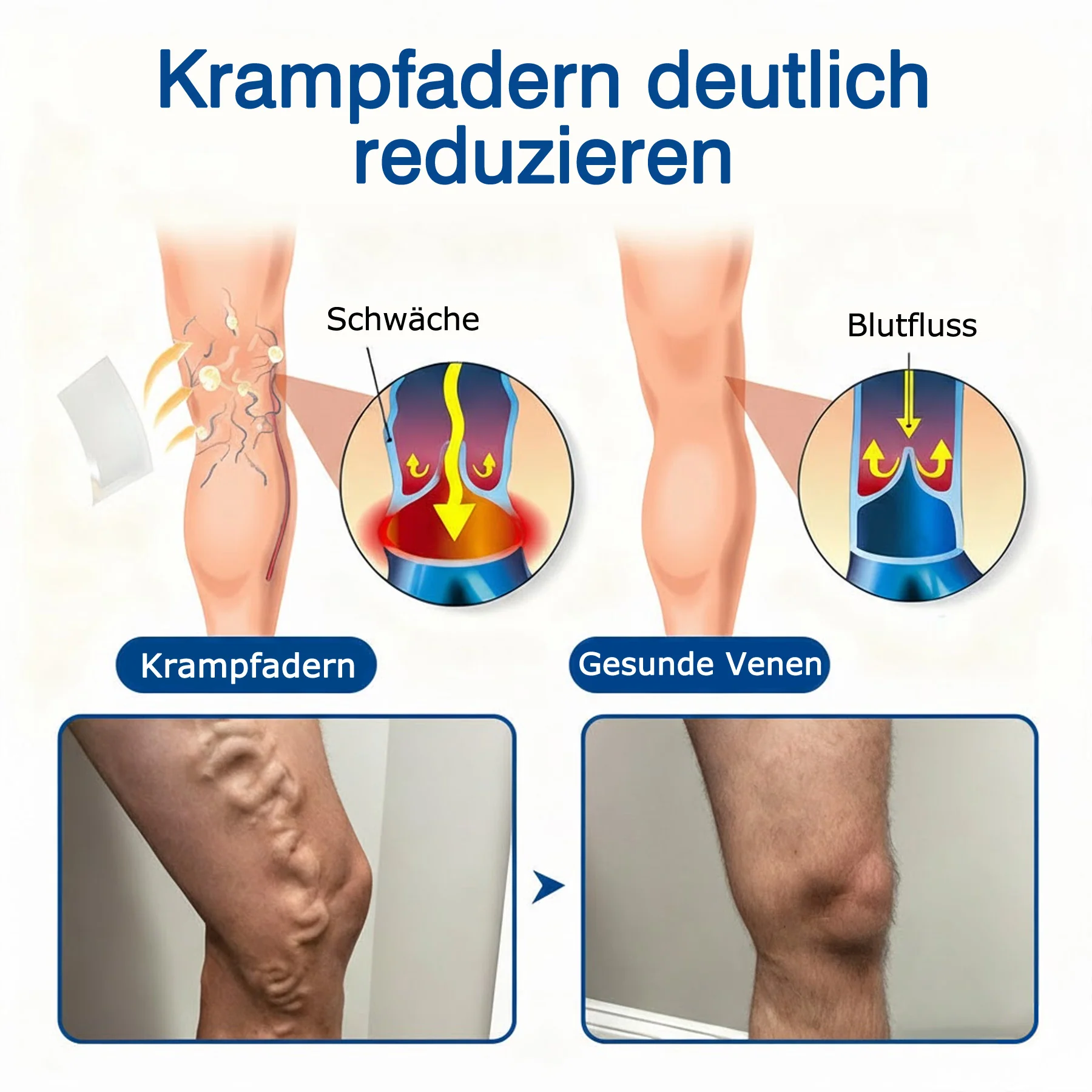 🇩🇪👨⚕️💥 GFOUK® VeinTarget Mikronadel-Pflaster ⚡ Sofortige Linderung, Langfristige Ergebnisse - Image 4