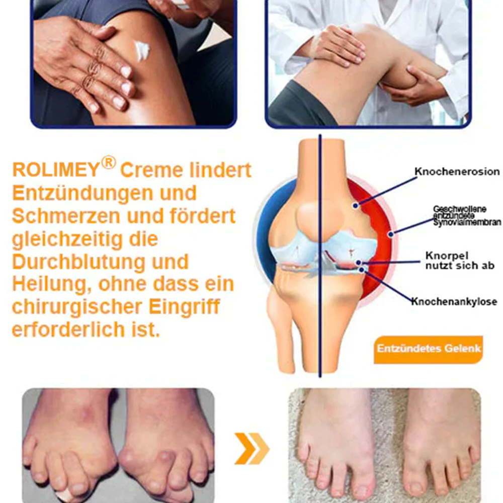 ✅ Offizieller Shop: Rolimey® Bienengift-Schmerzlinderungs Knochenheilungs Creme 👨⚕️(Reduzierung von Gelenkschwellungen, Schmerzen, Steifheit, Rötungen, Wärme, Muskelkater und Gelenkmüdigkeit) - Image 11