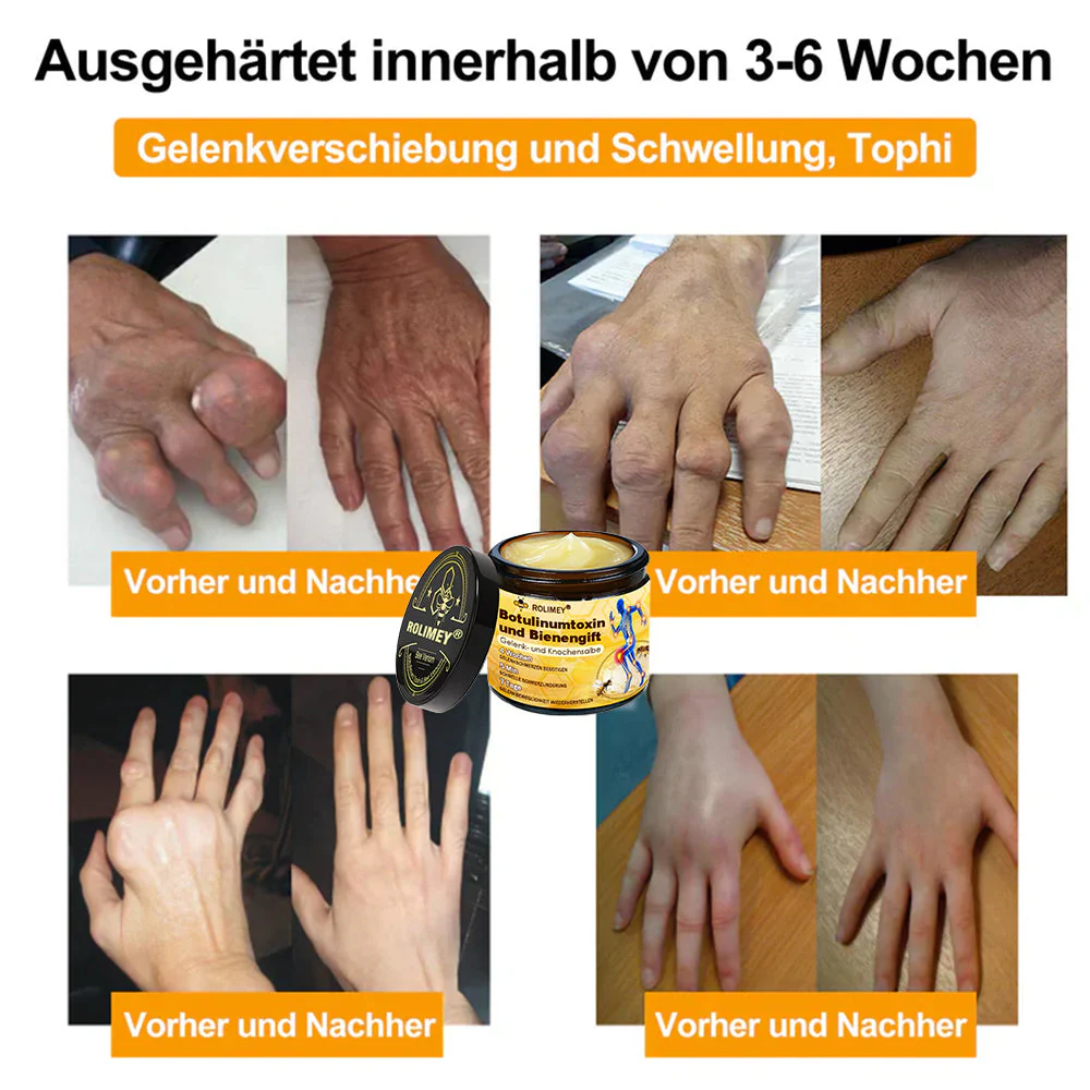✅ Offizieller Shop: Rolimey® Bienengift-Schmerzlinderungs Knochenheilungs Creme 👨⚕️(Reduzierung von Gelenkschwellungen, Schmerzen, Steifheit, Rötungen, Wärme, Muskelkater und Gelenkmüdigkeit) - Image 3