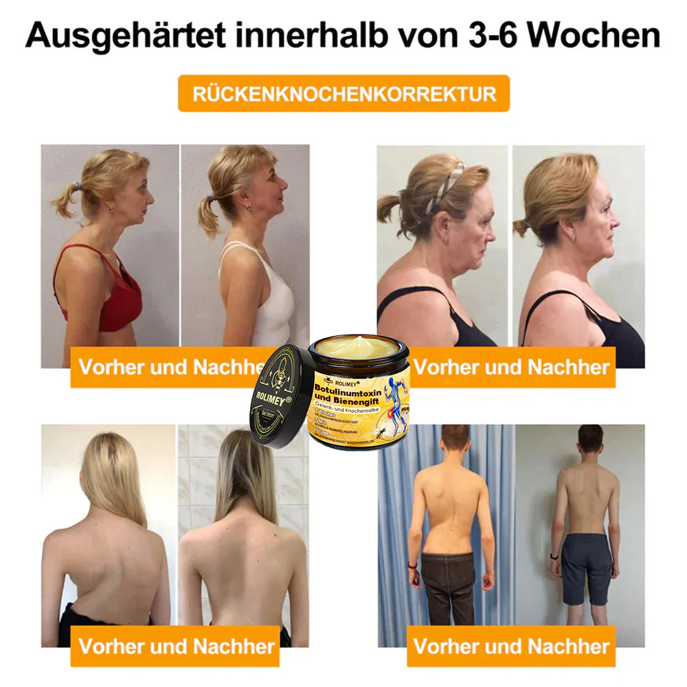 ✅ Offizieller Shop: Rolimey® Bienengift-Schmerzlinderungs Knochenheilungs Creme 👨⚕️(Reduzierung von Gelenkschwellungen, Schmerzen, Steifheit, Rötungen, Wärme, Muskelkater und Gelenkmüdigkeit) - Image 4