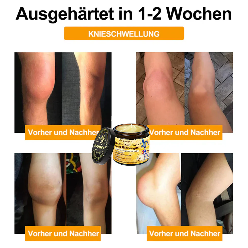 ✅ Offizieller Shop: Rolimey® Bienengift-Schmerzlinderungs Knochenheilungs Creme 👨⚕️(Reduzierung von Gelenkschwellungen, Schmerzen, Steifheit, Rötungen, Wärme, Muskelkater und Gelenkmüdigkeit) - Image 5