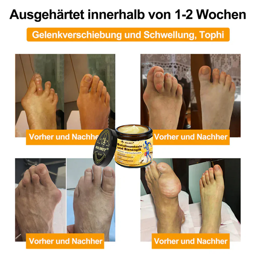 ✅ Offizieller Shop: Rolimey® Bienengift-Schmerzlinderungs Knochenheilungs Creme 👨⚕️(Reduzierung von Gelenkschwellungen, Schmerzen, Steifheit, Rötungen, Wärme, Muskelkater und Gelenkmüdigkeit) - Image 6