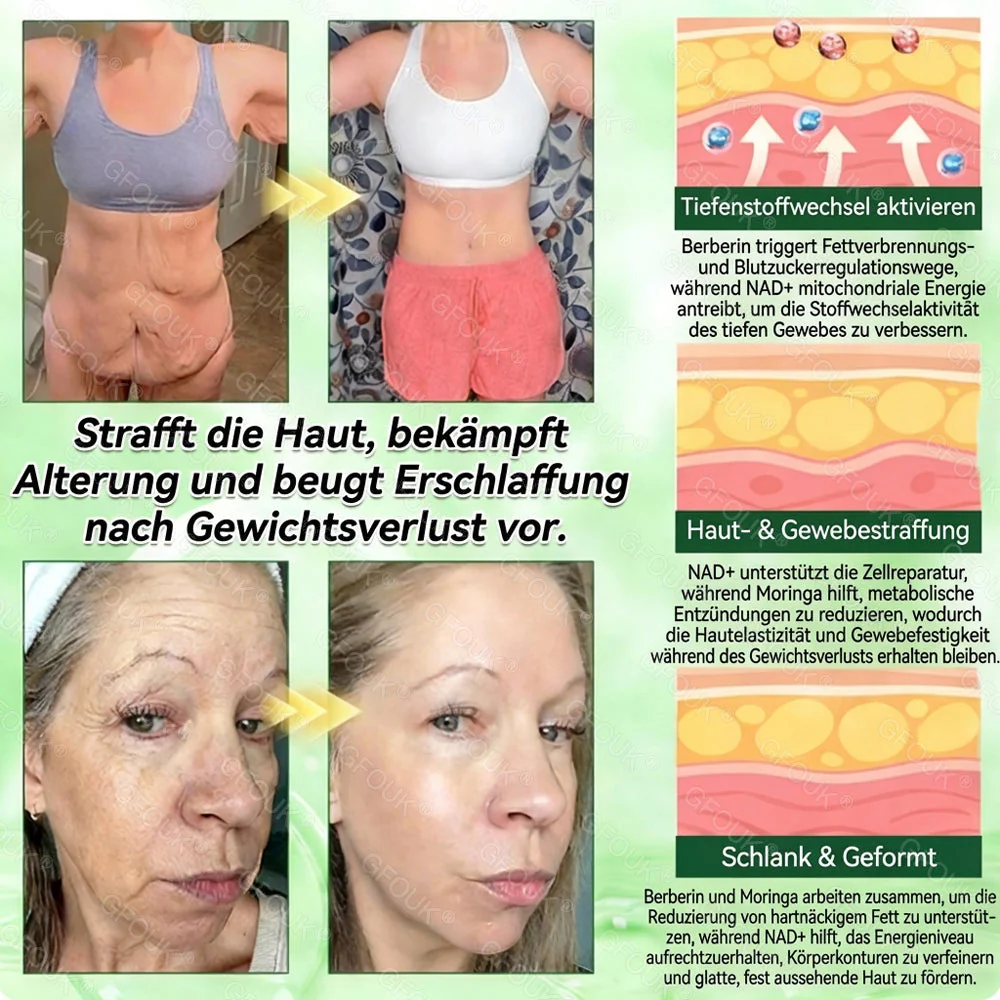 🇩🇪Offizieller Shop | 💥🔥 GFOUK® Moringa Berberinex NAD+ 10-in-1 Nano-Mikronadel-Patch (Nur einmal täglich, sichtbare Veränderungen in 7 Tagen) ✅ Für Übergewicht, lockere Haut, Diabetes, Schlafapnoe, Gelenkprobleme und mehr - Image 3