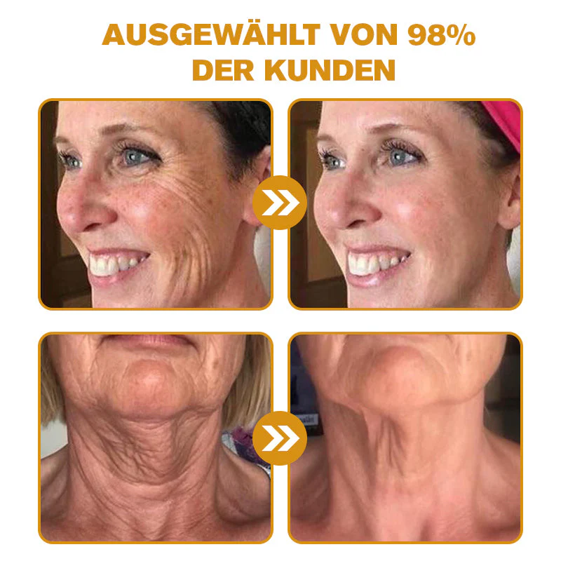 Genieße 30 % Rabatt beim Hinzufügen des zweiten Artikels 🧡 - Image 3