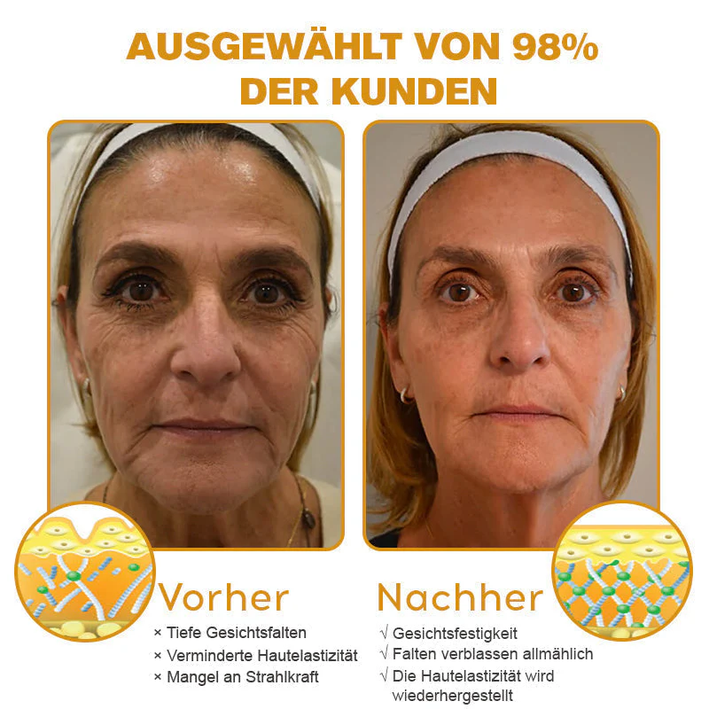 Genieße 30 % Rabatt beim Hinzufügen des zweiten Artikels 🧡 - Image 4