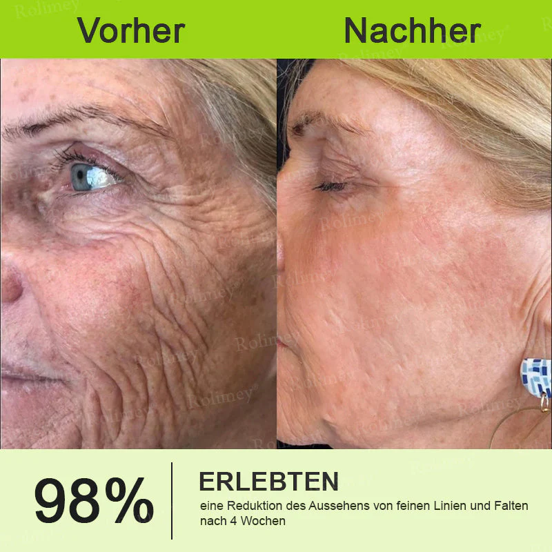 💥Jetzt jugendliche Haut zurückgewinnen 💫Rolimey® Botox & Vita-A Retinol Shot Falten-Lift Straffungscreme - Image 12