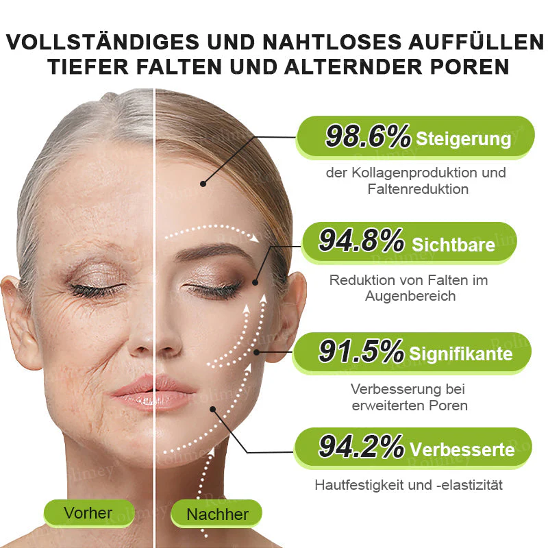 💥Jetzt jugendliche Haut zurückgewinnen 💫Rolimey® Botox & Vita-A Retinol Shot Falten-Lift Straffungscreme - Image 16