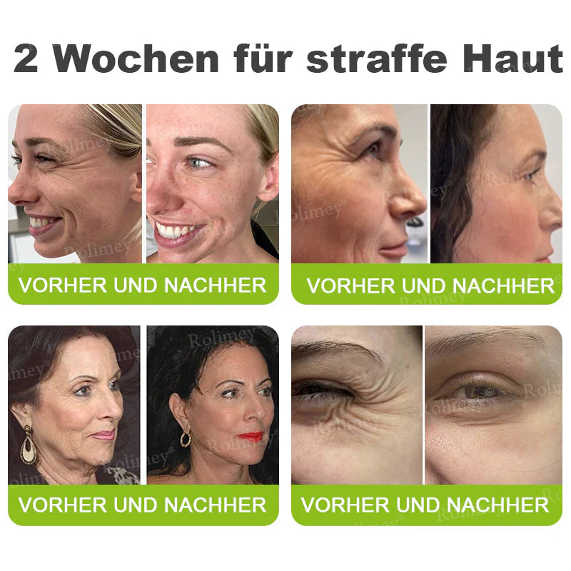 💥Jetzt jugendliche Haut zurückgewinnen 💫Rolimey® Botox & Vita-A Retinol Shot Falten-Lift Straffungscreme - Image 6