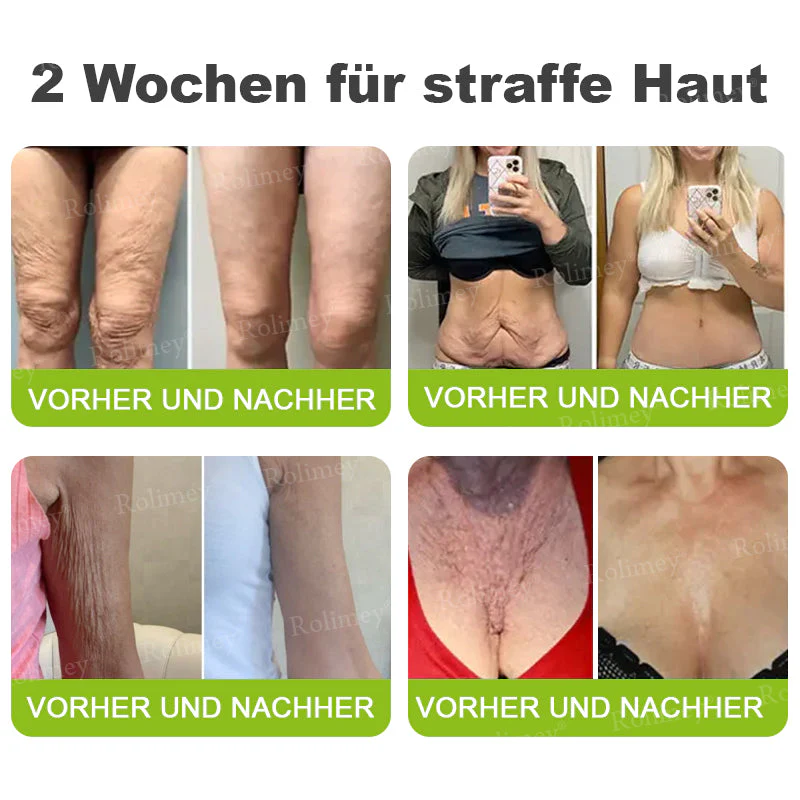 💥Jetzt jugendliche Haut zurückgewinnen 💫Rolimey® Botox & Vita-A Retinol Shot Falten-Lift Straffungscreme - Image 7
